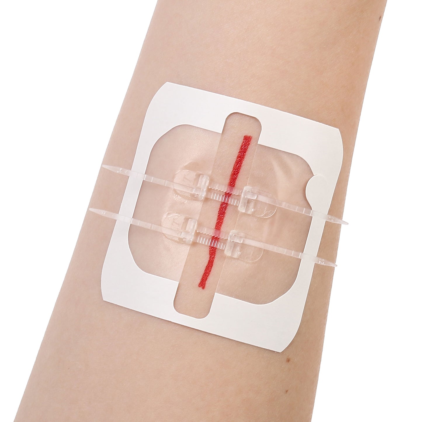 LotFancy Emergency Wound Closures, First Aid Supplies, Medical Butterfly Bandaids, Surgical Sutures Laceration Repair Kit with Accessories, Sterile, Latex-Free