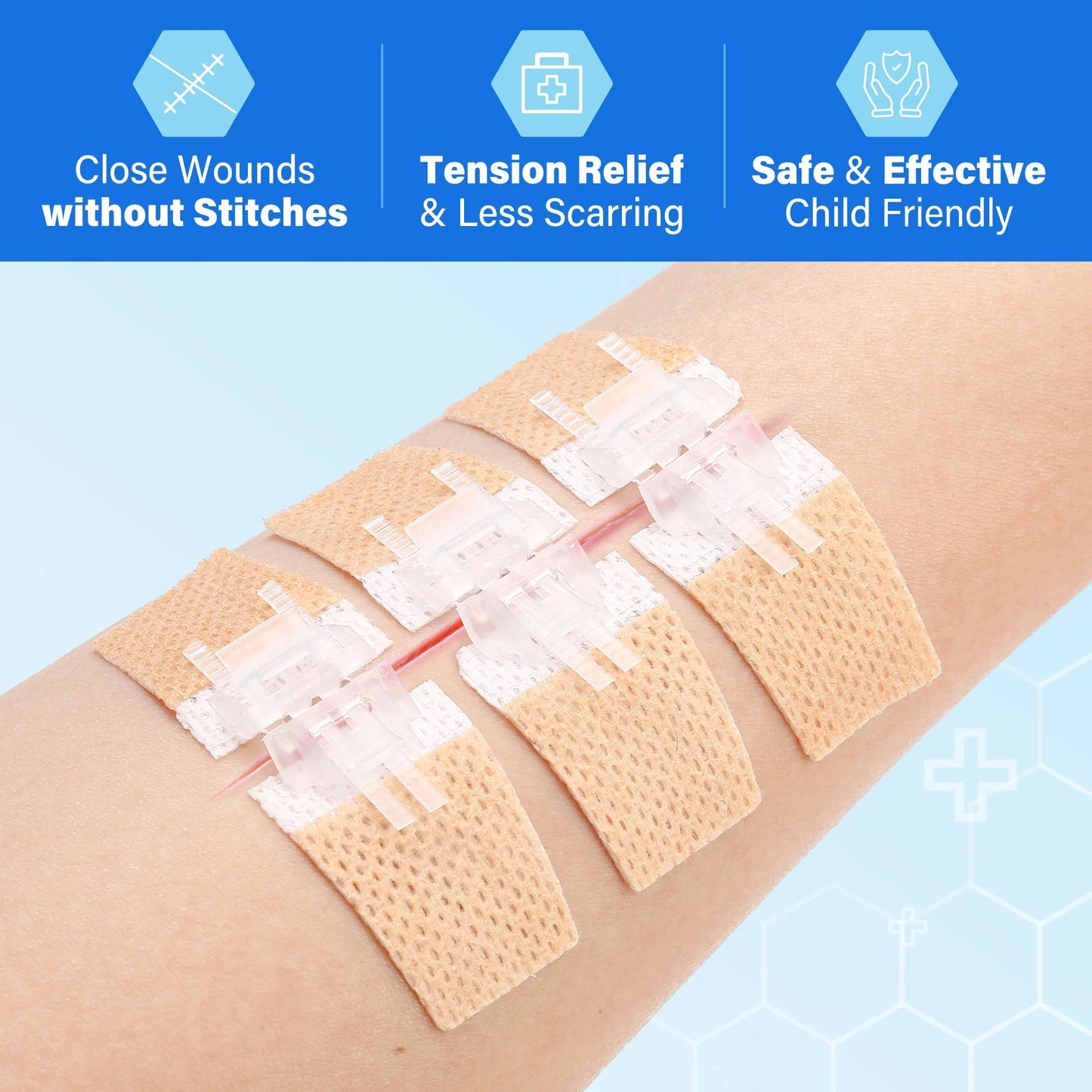LotFancy 4 Pack Zip Stitch Sutures, Emergency Surgical Wound Closure Strips, Butterfly Bandages