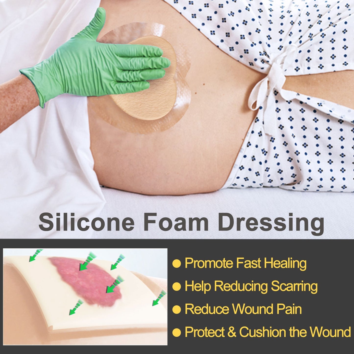 LotFancy Silicone Foam Dressing, Wound Dressing with Border, Bed Sores, Pressure Ulcers Healing Bandage Pad, Highly Absorbent, Waterproof