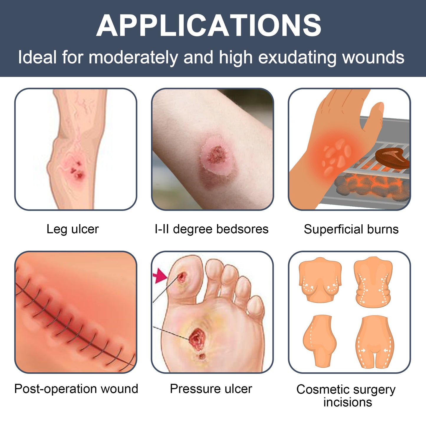 LotFancy Calcium Alginate Wound Dressing, 4" x 8", 5 Pack, Non-Stick Gauze Pads, Highly Absorbent