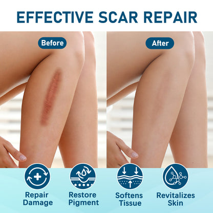 LotFancy Silicone Scar Sheets, 10 Silicone Scar Tape for C-Section, Keloid Bump, Burn, Acne,1.5 x 6in