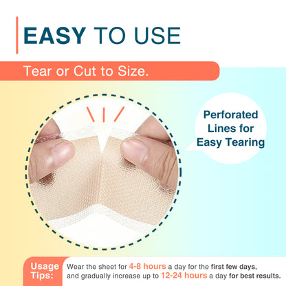 MEDLOT Silicone Scar Tape, Silicone Scar Sheets for Scar Treatment, Reusable, 1.5" x 78" Roll