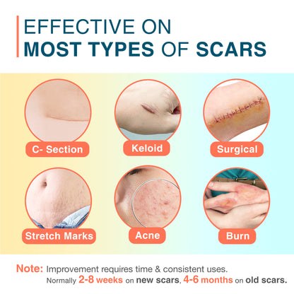 MEDLOT Silicone Scar Sheets, 1.5" x 156" Roll, Reusable Silicone Scar Strips for Scar Treatment
