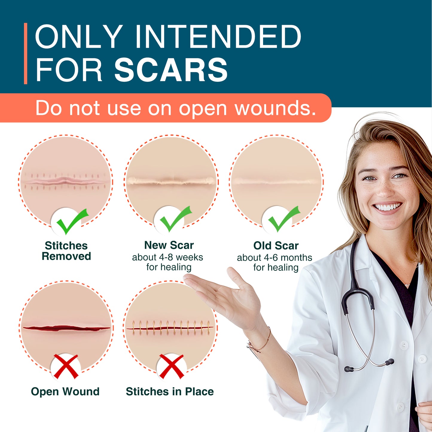 MEDLOT Silicone Scar Sheets, 1.5" x 156" Roll, Reusable Silicone Scar Strips for Scar Treatment