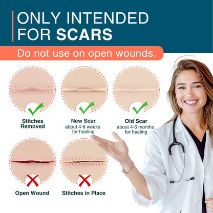 MEDLOT Silicone Scar Sheets, 1.5" x 156" Roll, Reusable Silicone Scar Strips for Scar Treatment