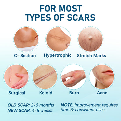 LotFancy Silicone Scar Sheets, 10 Silicone Scar Tape for C-Section, Keloid Bump, Burn, Acne,1.5 x 6in