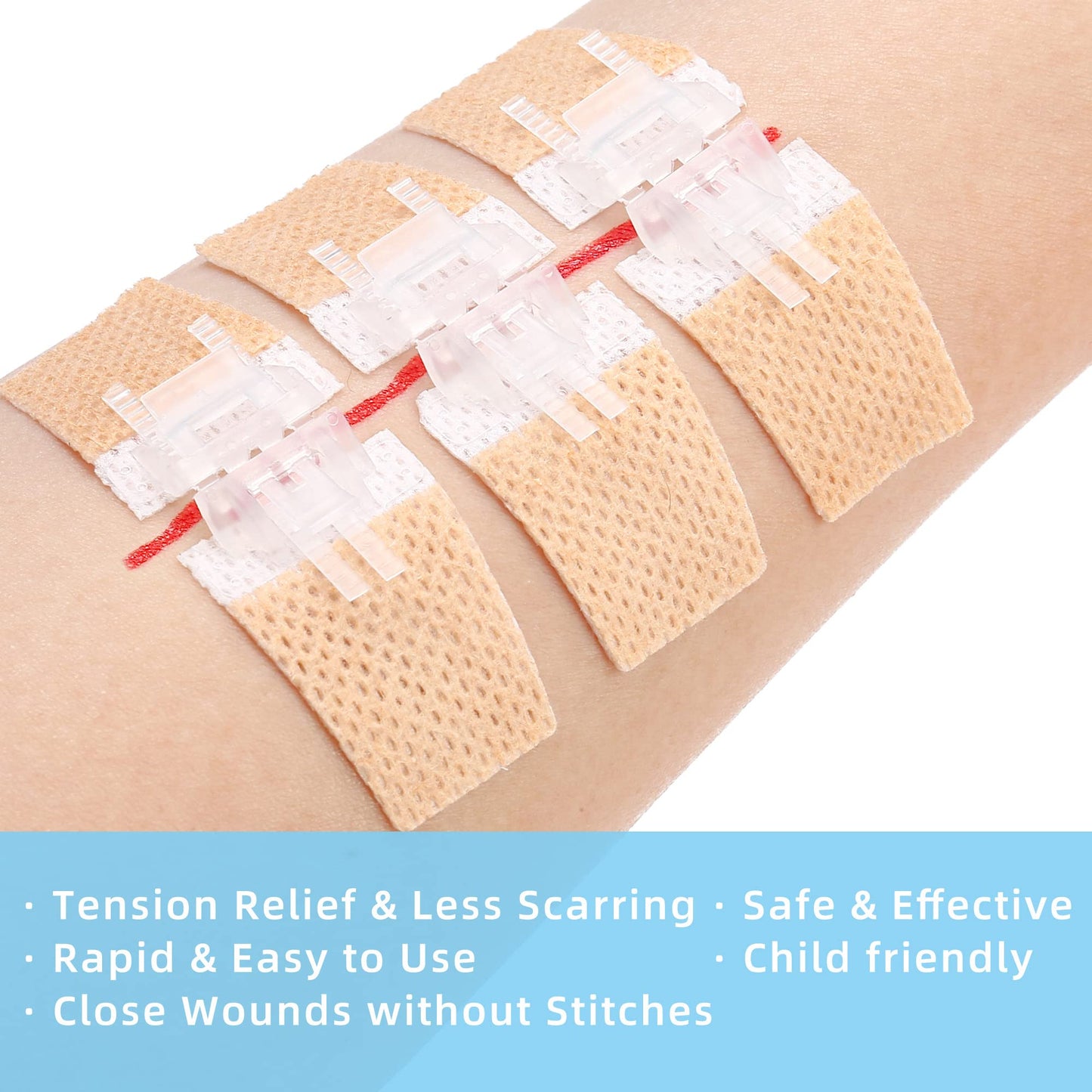 Emergency Laceration Closure Kit for Lacerations and Cuts